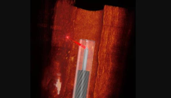  使用3D微型打印技術開發了 上 小的靈活血管內窺鏡